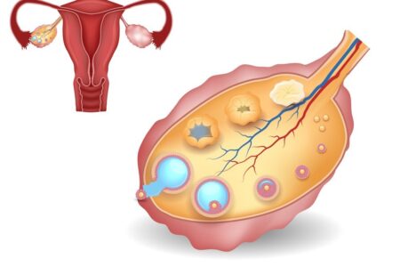 Nearest gynecologist in Chichwad Nearest gynecologist in Chichwad