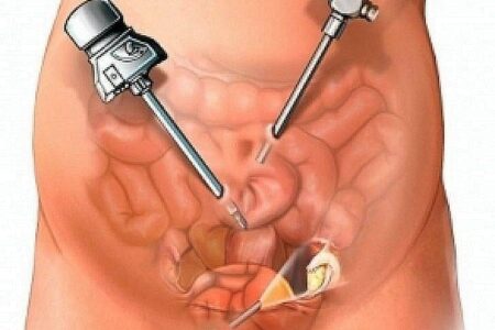 Nearest gynecologist in Thergaon Nearest gynecologist in Thergaon