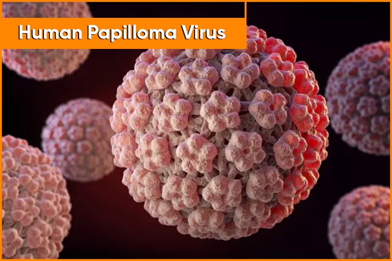 Treatment for Human papillon virus in WAKAD